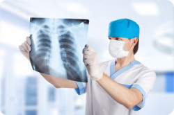 Рентген грудной клетки при туберкулезе