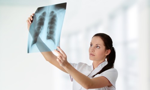 Рентгенологическое обследование легких