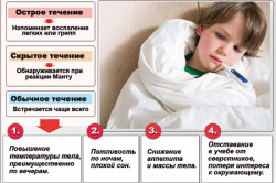 Симптомы туберкулеза у детей