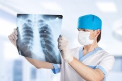 Анализ рентгена легких на туберкулез